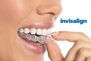 Invisalign in Kitchener- Waterloo, ON