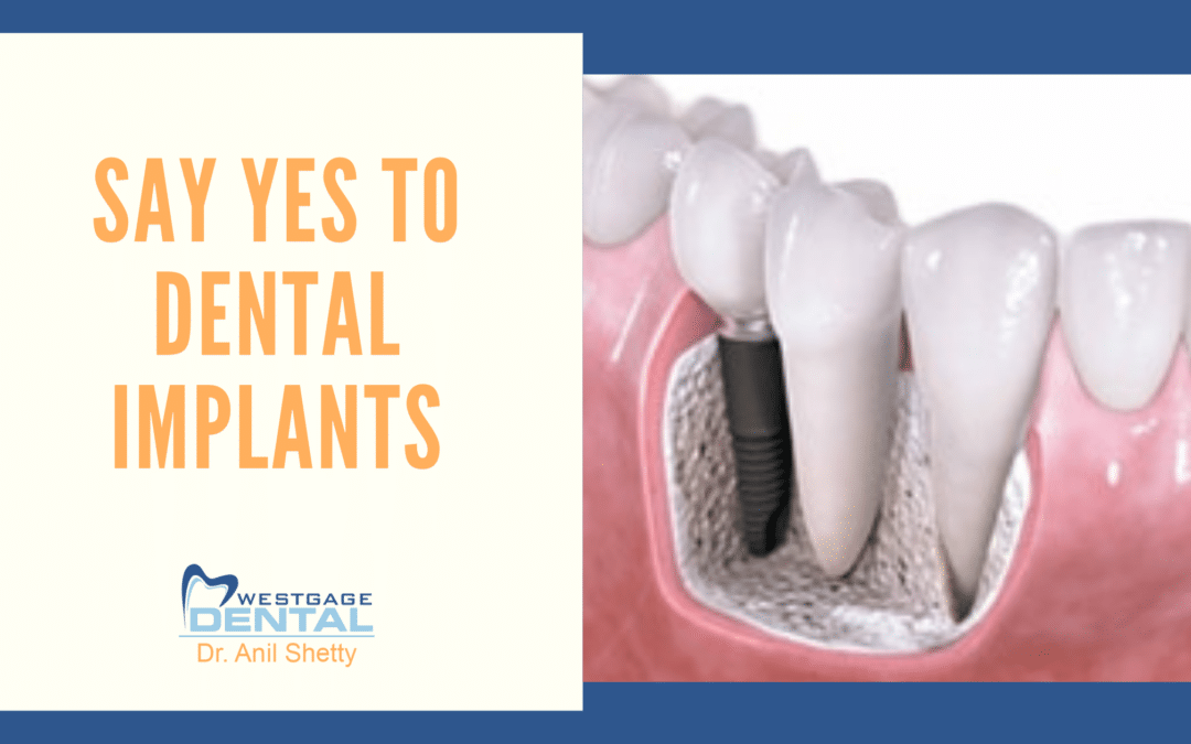 Say YES to dental implants