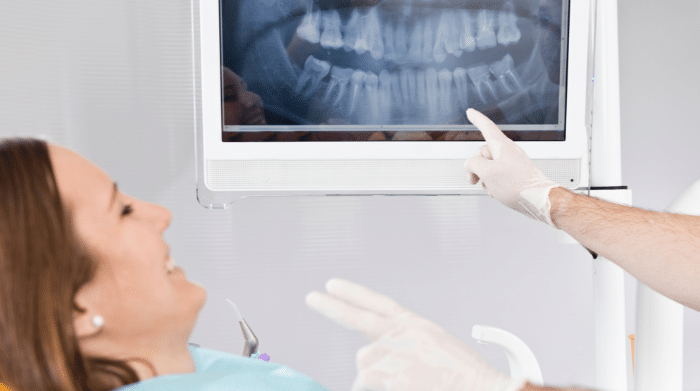 Dentist  explaning oral health concerns during dental checkup in Kitchener
